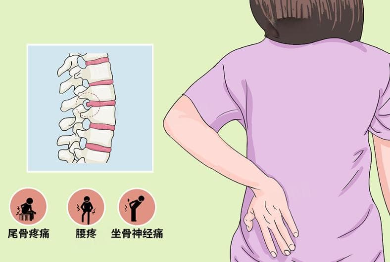 腰间盘突出做什么运动比较好恢复