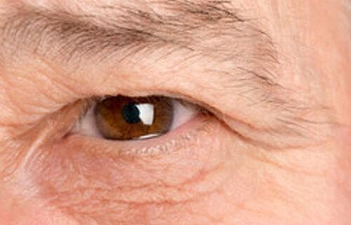 常见老年性眼疾：白内障、青光眼和糖尿病视网膜病变
