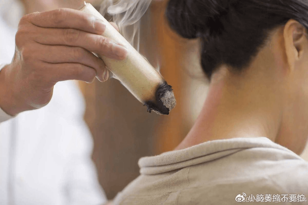 中医经络养生：疏通经络，强身健体