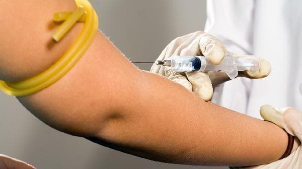 甲状腺抽血检查包括哪些项目？医生告诉你