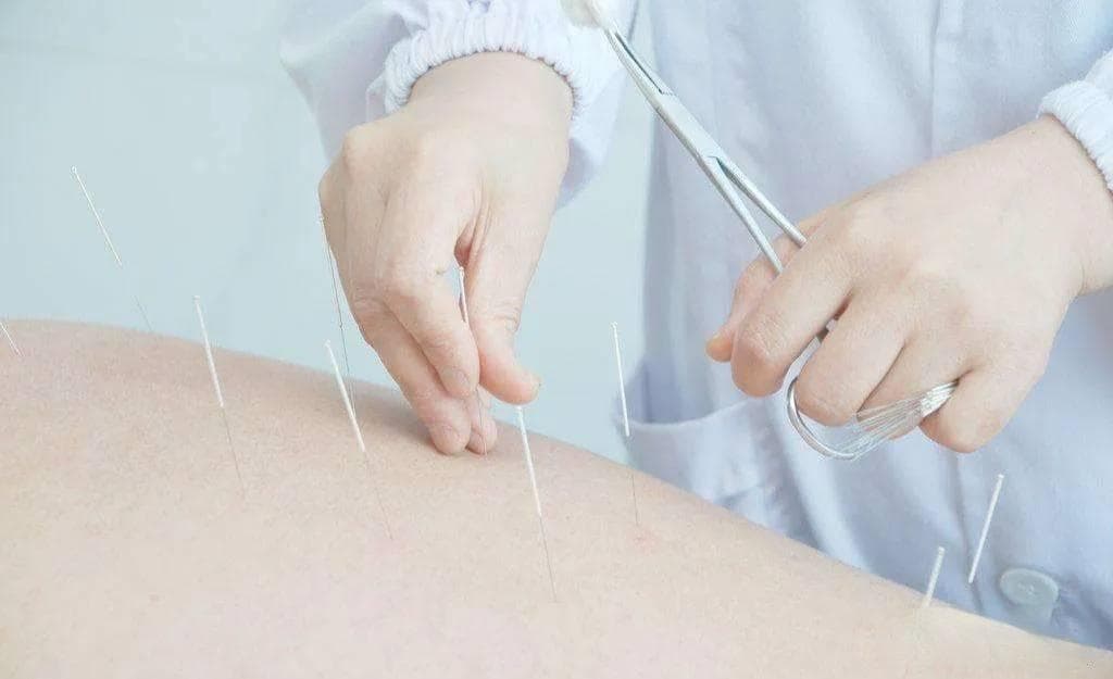 科学重塑针灸未来：穿越争议，筑就共识之路