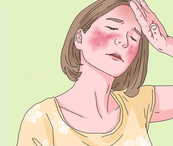 结缔组织疾病：病因、症状、诊断与治疗全解析