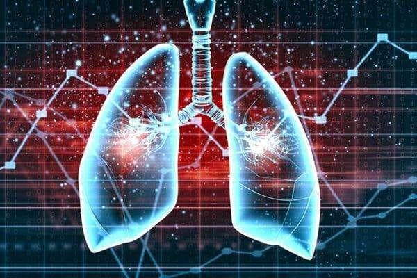 肺癌患者如何进行营养支持？