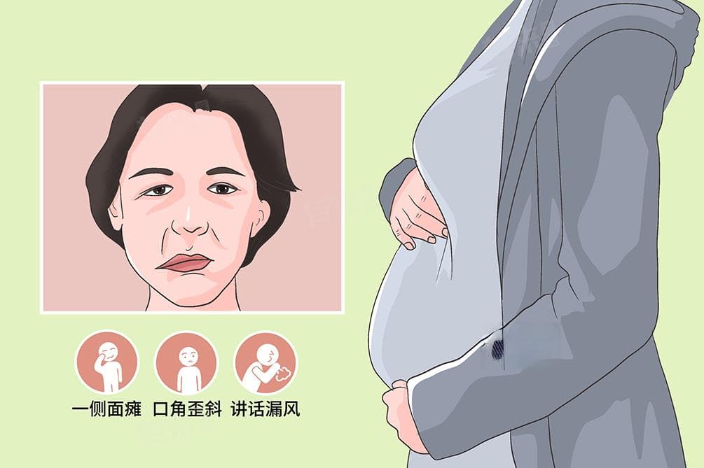 面部神经炎的治疗方法及注意事项