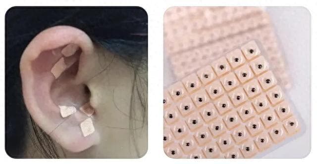 活血通经、利尿通淋——王不留行