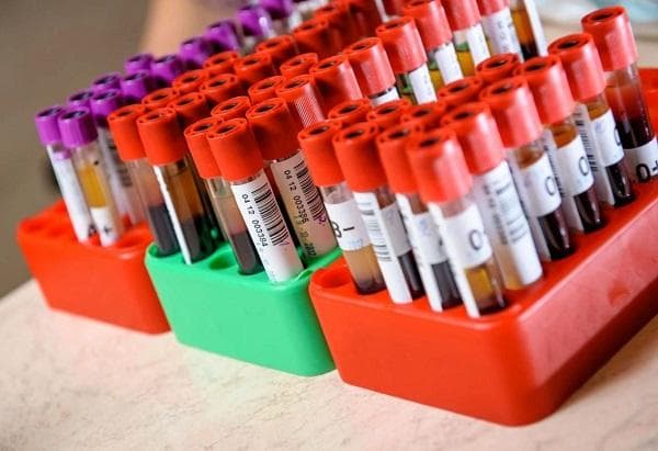 CRP和超敏CRP傻傻分不清楚？一文读懂它们的区别