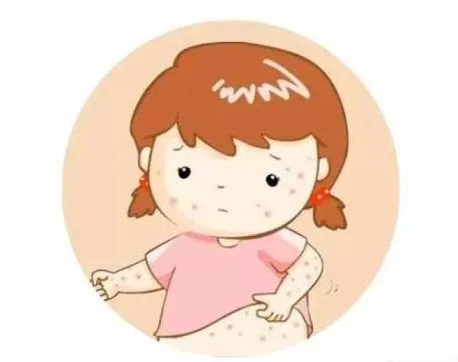 秋冬季常见传染病及防控要点