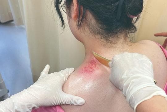 中医丨祛除邪气、疏通经络......小小刮痧板，养生作用大！