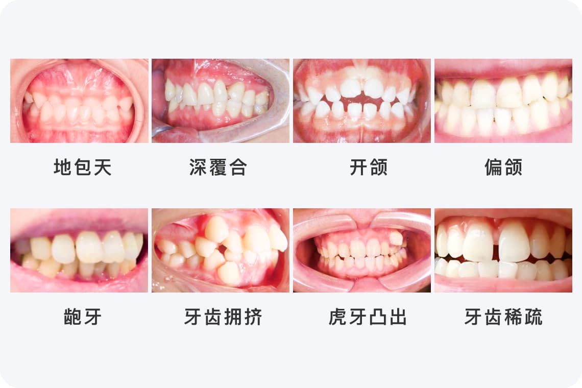 35岁还能矫正牙齿吗，还有效果吗