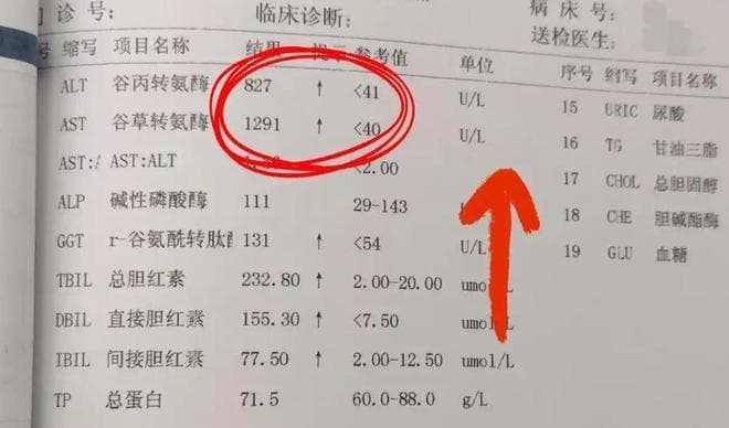 乙肝患者多久检查一次？这些情况提示病情好转