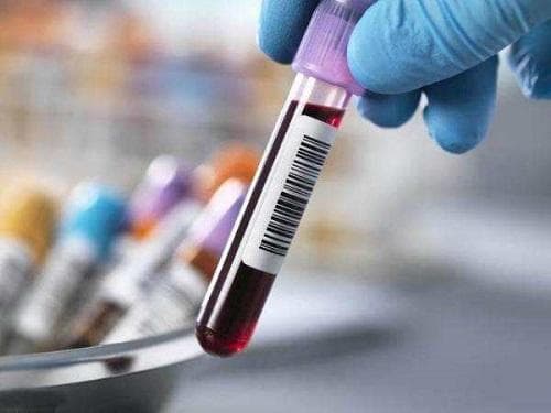 怎样通过运动与饮食来有效调理内分泌失调的情况？