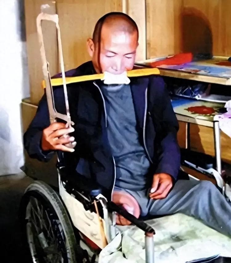 13年前拿不出100万治疗费，在家锯腿求生的河北男子，如今怎样了