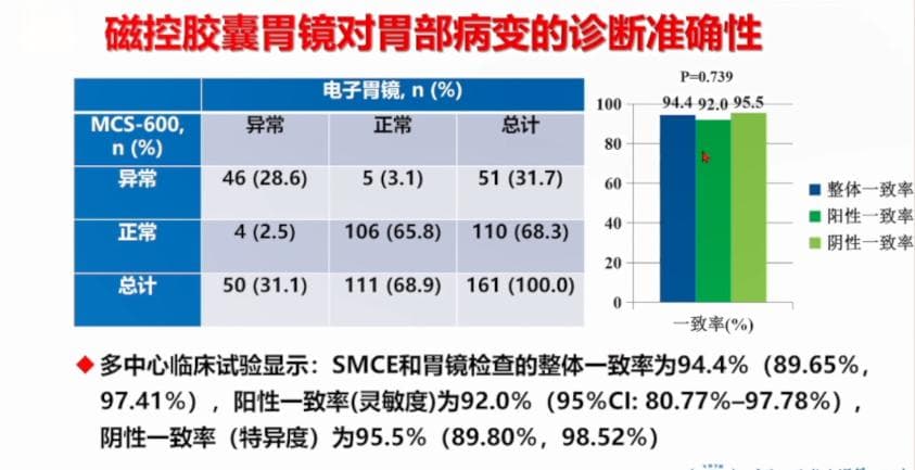 磁控胶囊胃镜：无创检查精度达94%，双体位设计更人性化