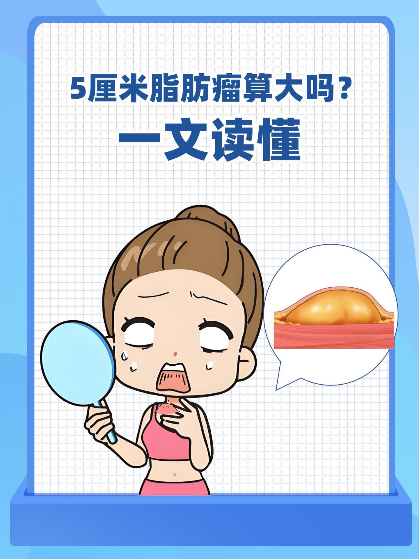 5厘米脂肪瘤算大吗？一文读懂