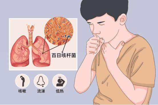 痰液是身体健康的“预警信号”？不同颜色的痰液，可能暗藏这些健康隐患