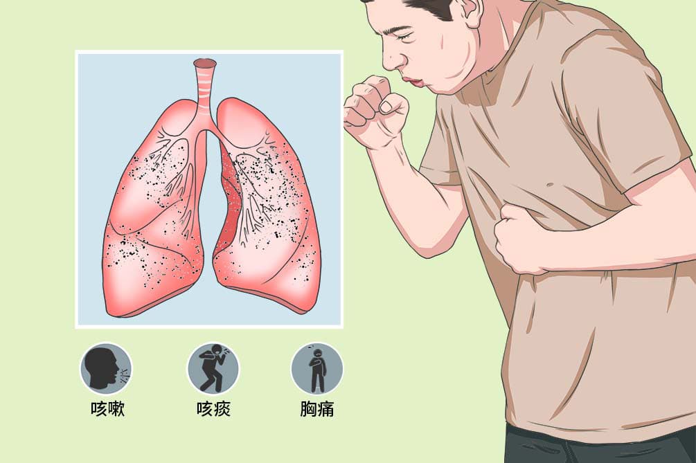 肺部病变的鉴别方法