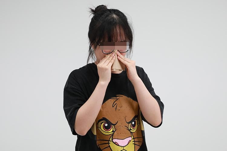 猫毛过敏有哪些症状图片
