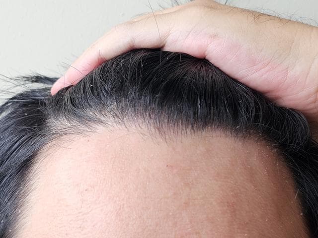 克夫相标准有哪些？克夫相特征分析