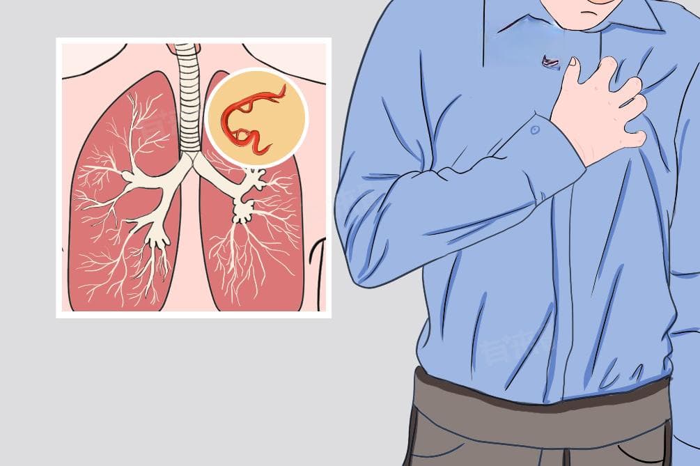 血吸虫长什么样？如何预防血吸虫感染？