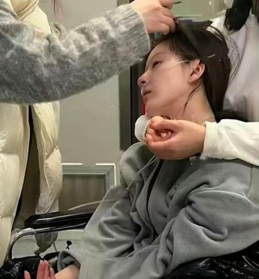 赵露思患失语症，揭秘背后医学真相