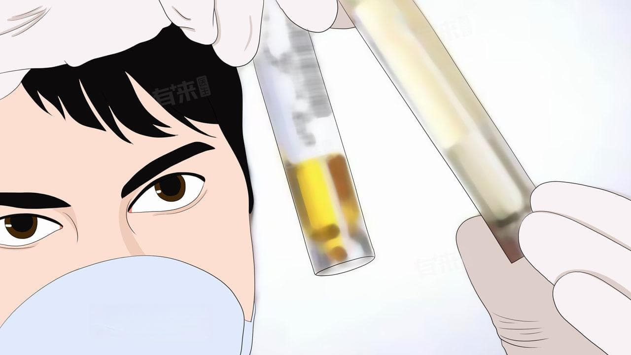 尿蛋白阳性是什么意思？严重吗？