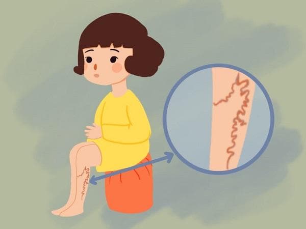 地奥司明的作用机制