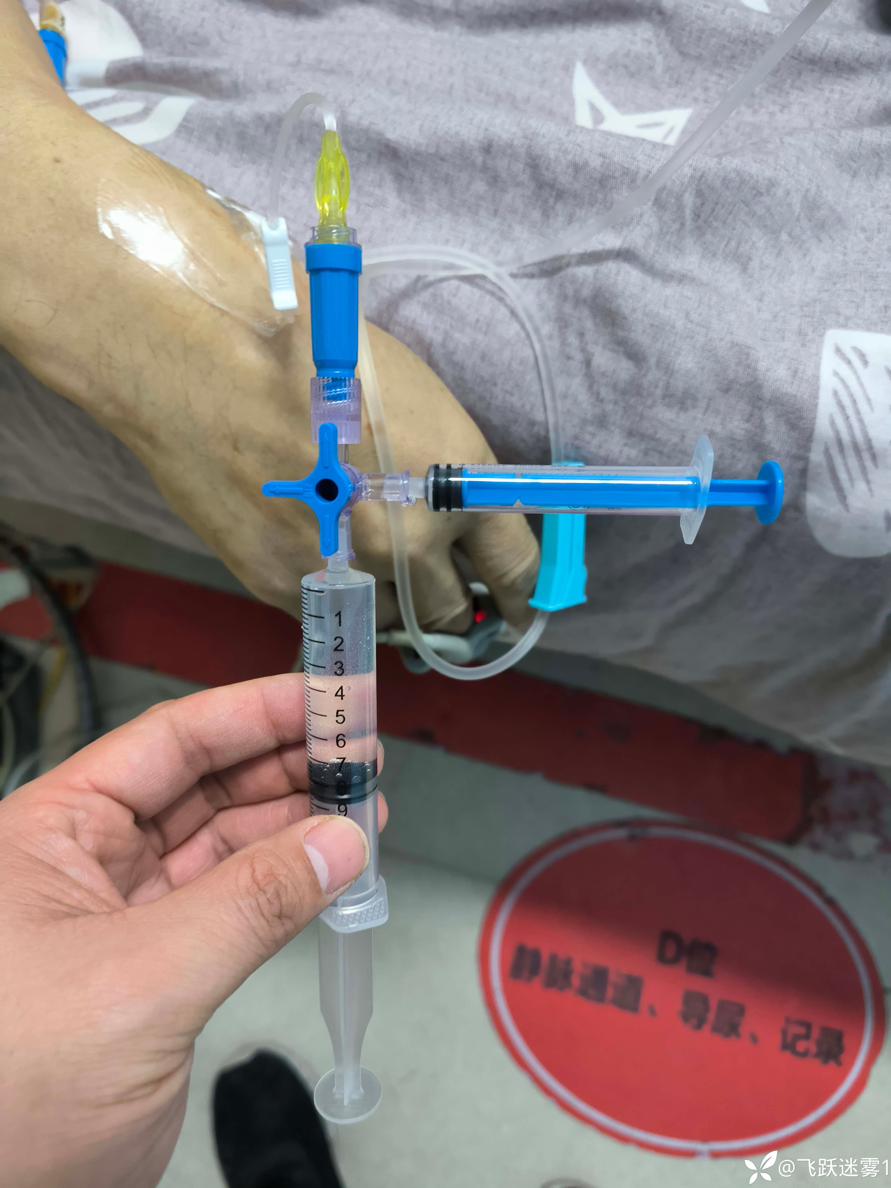 医院有腺苷了，腺苷用于治疗室上速的总结