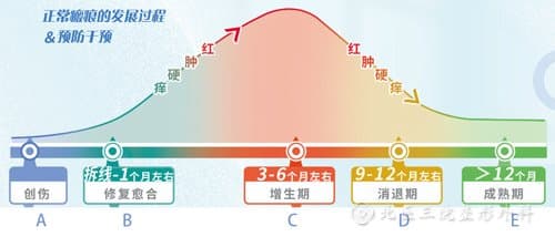 瘢痕是需要管理的