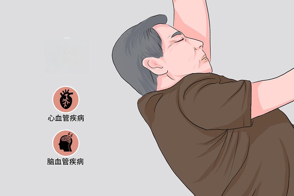 昏睡：病因、症状、就医指南及预防措施