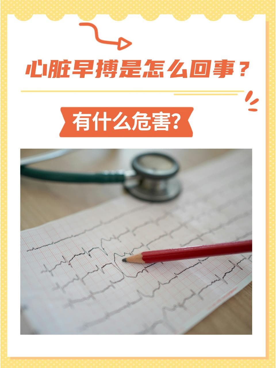心脏早搏是怎么回事？有什么危害？