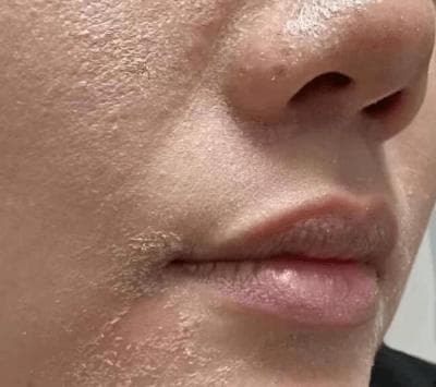 了解皮肤缺水信号，科学保湿策略打造水润肌肤