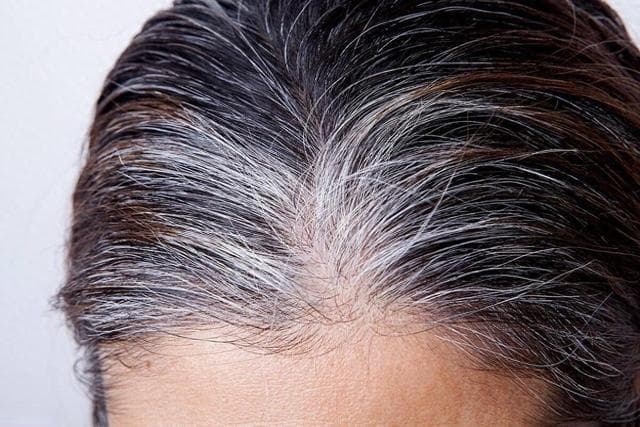 有些中老年人，白发又会变黑，这是为什么？