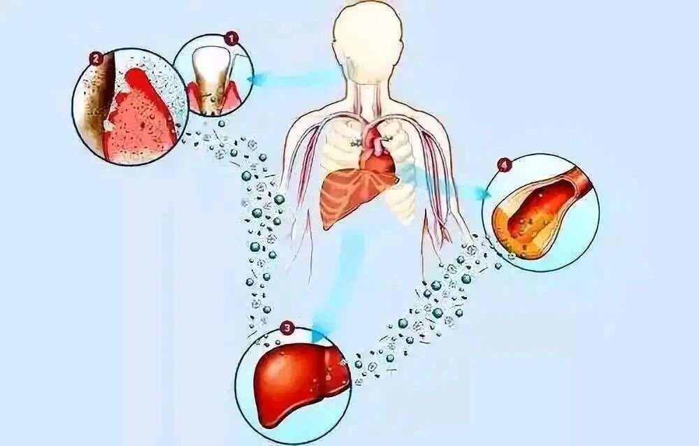 六款消炎中成药：抗生素的天然替代方案