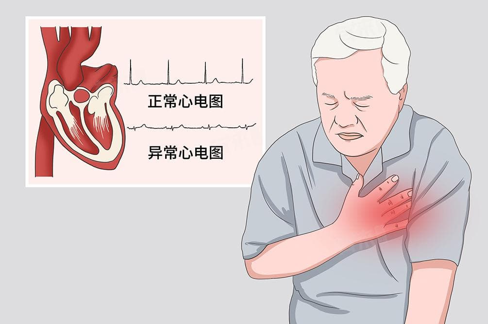 窦性心动过缓要紧吗？一文读懂其危害与日常注意事项