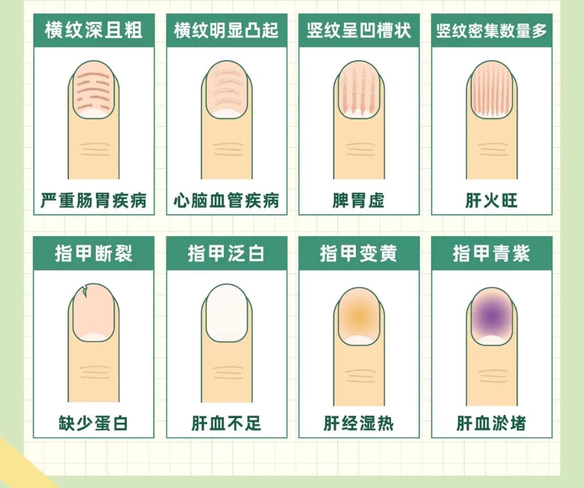 中医甲诊：从指甲看健康