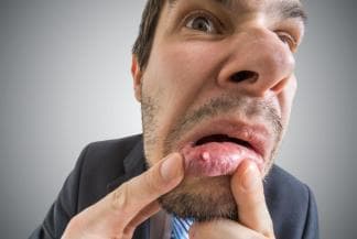 牙龈肿胀一查竟是血癌！教你三招自测！
