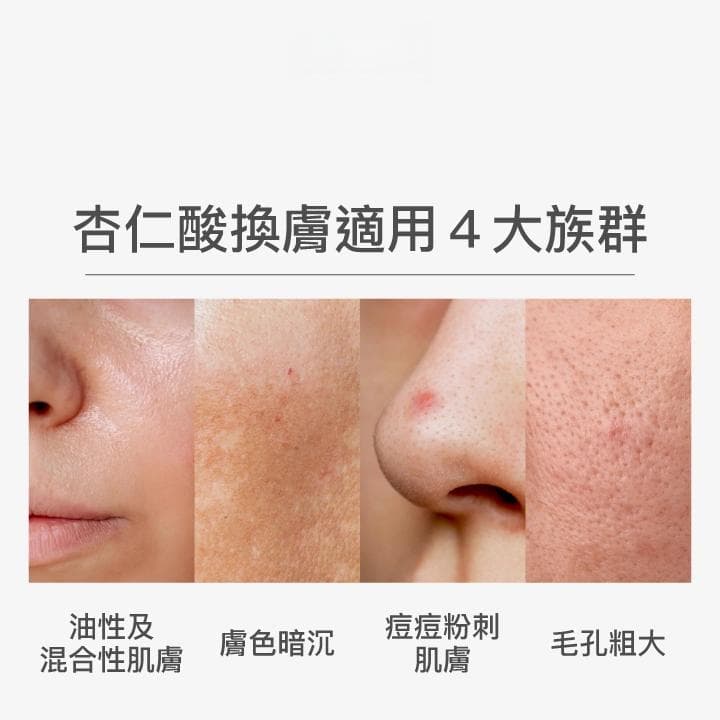 杏仁酸换肤完全指南：功效、适用人群、流程及注意事项