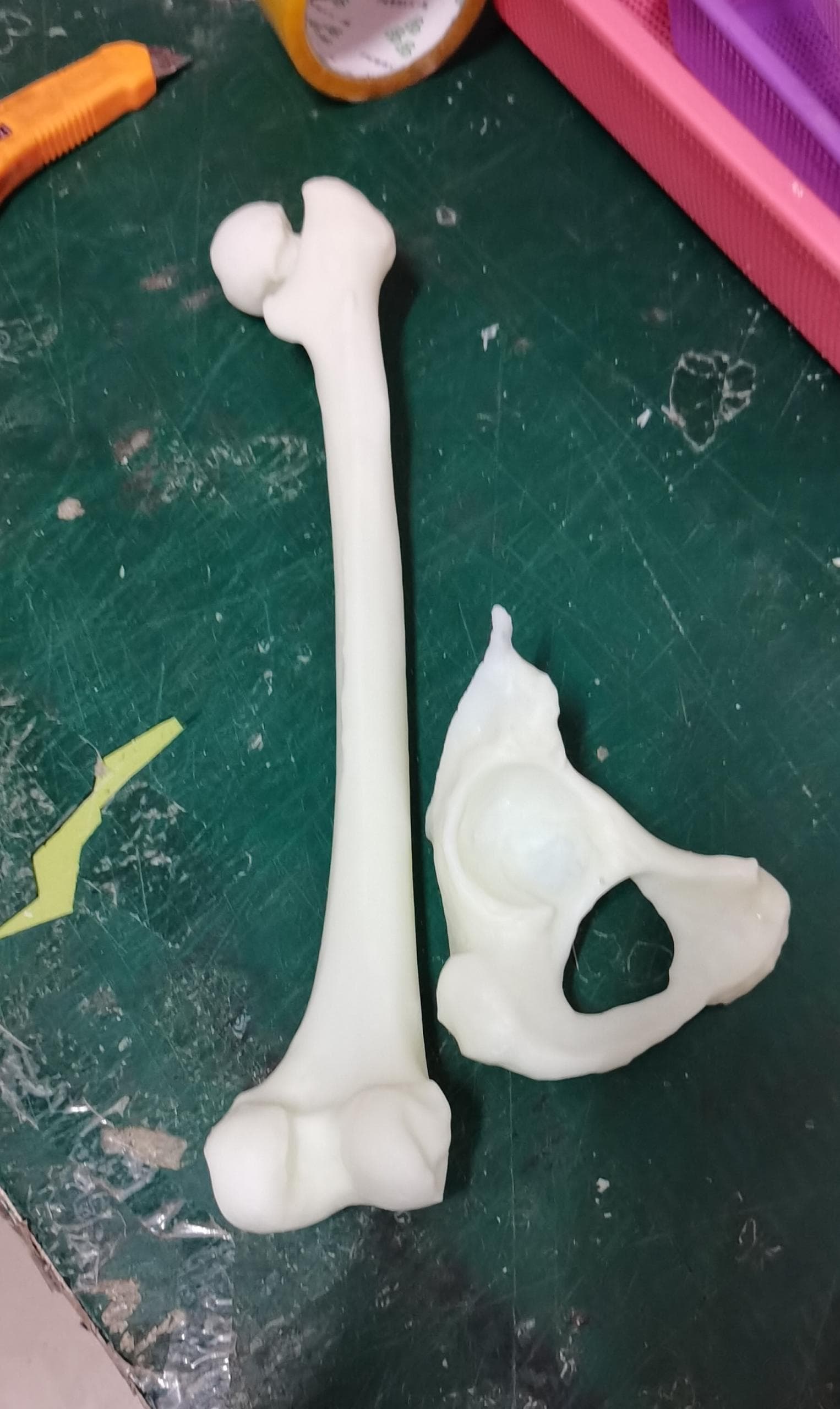 3D打印技术正改变着医疗领域