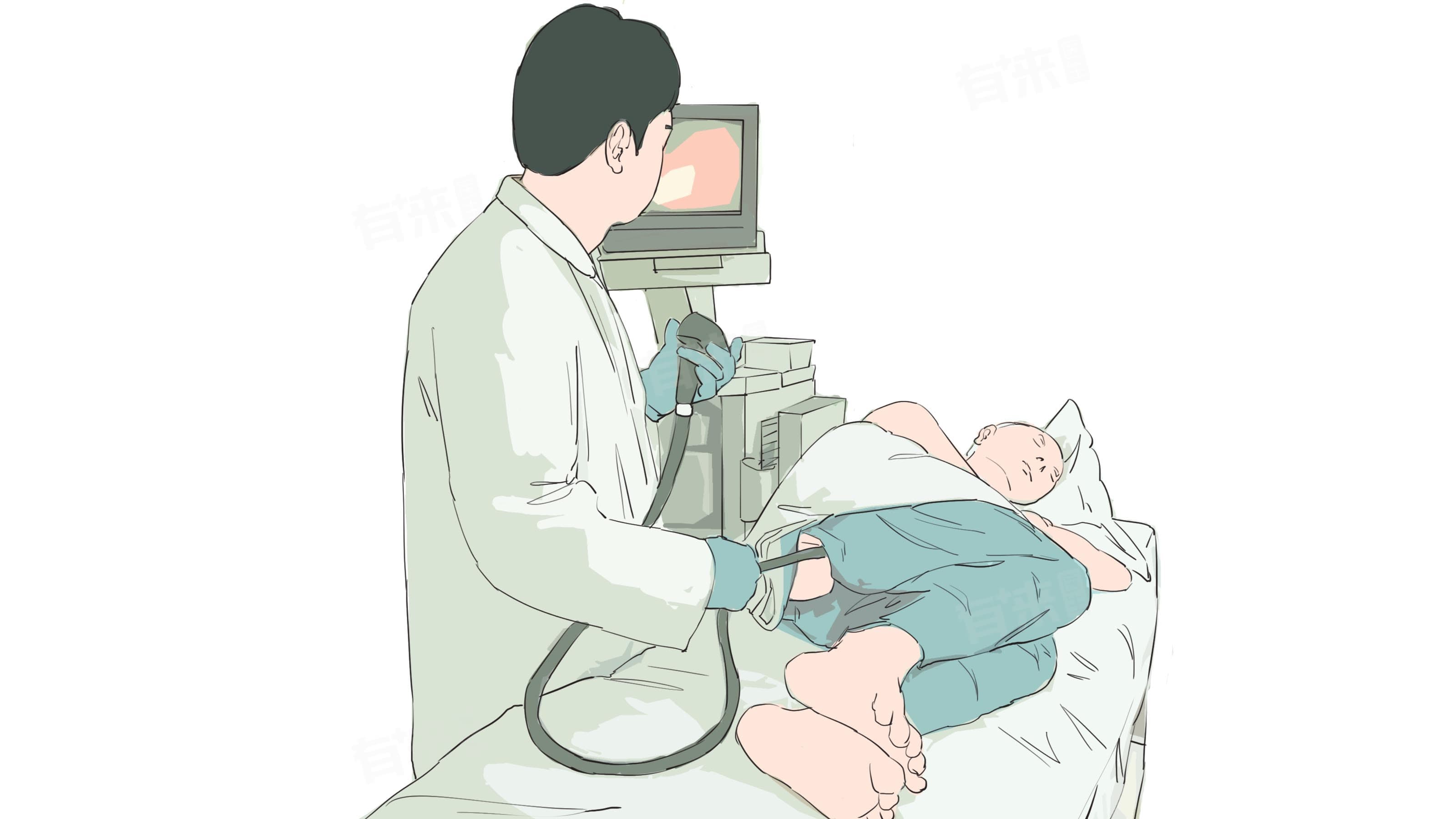 做完肠镜要休息几天