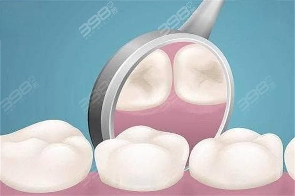 乳牙根管治疗有必要吗？对恒牙生长有影响吗？