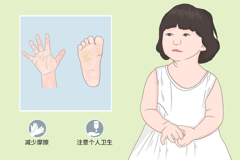 掌跖角化病：病因、症状、诊断与治疗全解析