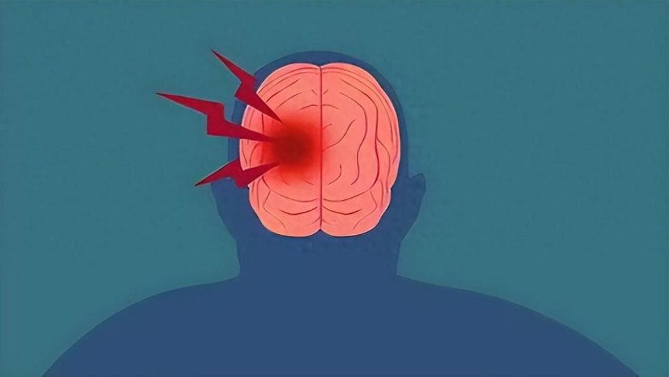 脑中风每年死亡率升高，出现这5个症状，立即就医！