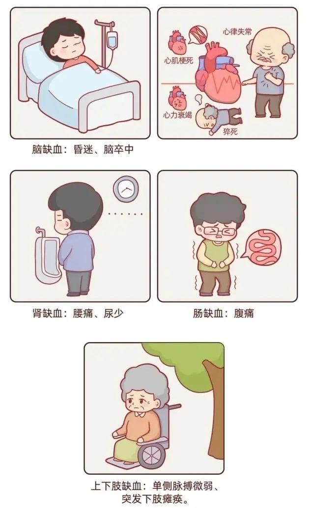 比心梗还凶险的胸痛！一文读懂主动脉夹层