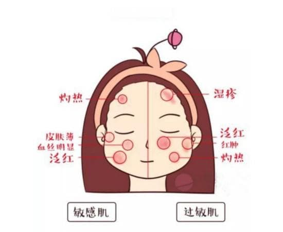 皮肤药物过敏红肿瘙痒，应对与护理指南