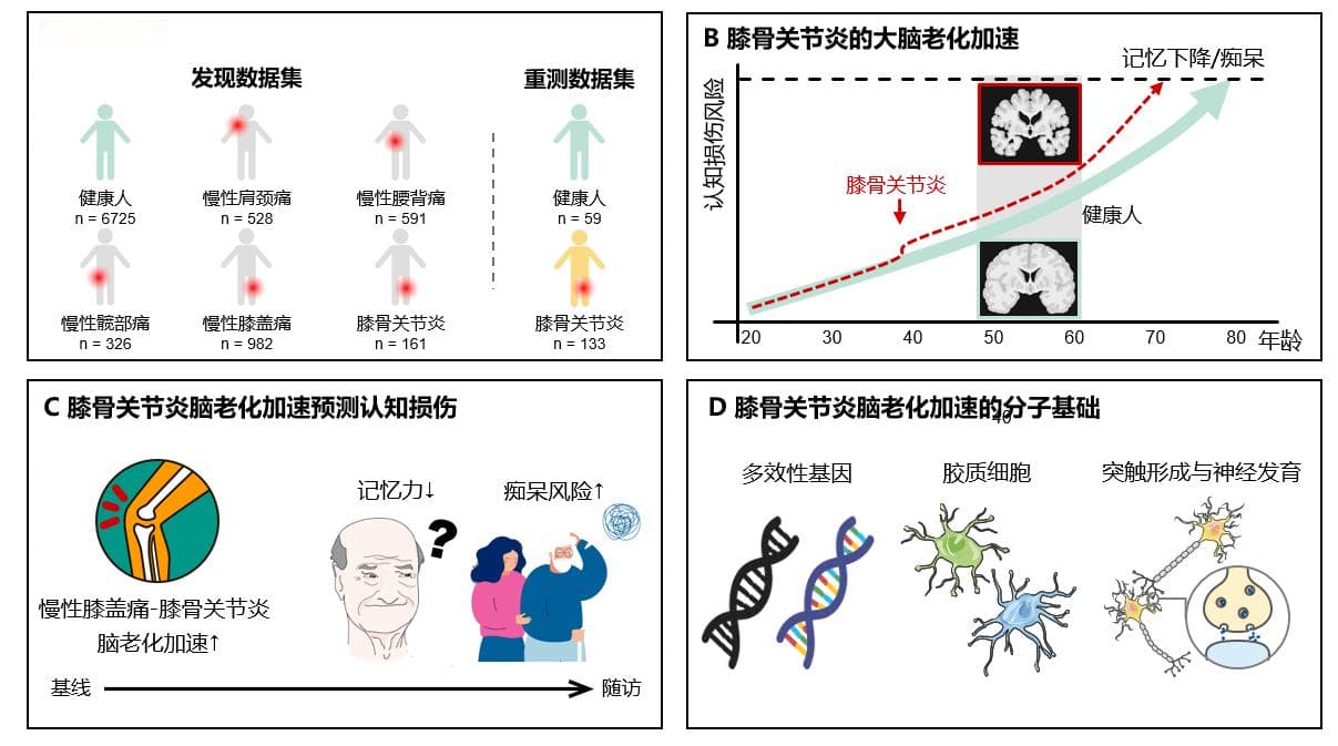 《自然》揭示慢性骨骼肌肉痛导致大脑老化的机制