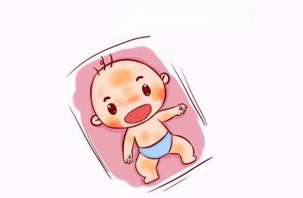 一次性讲明白——新生儿黄疸