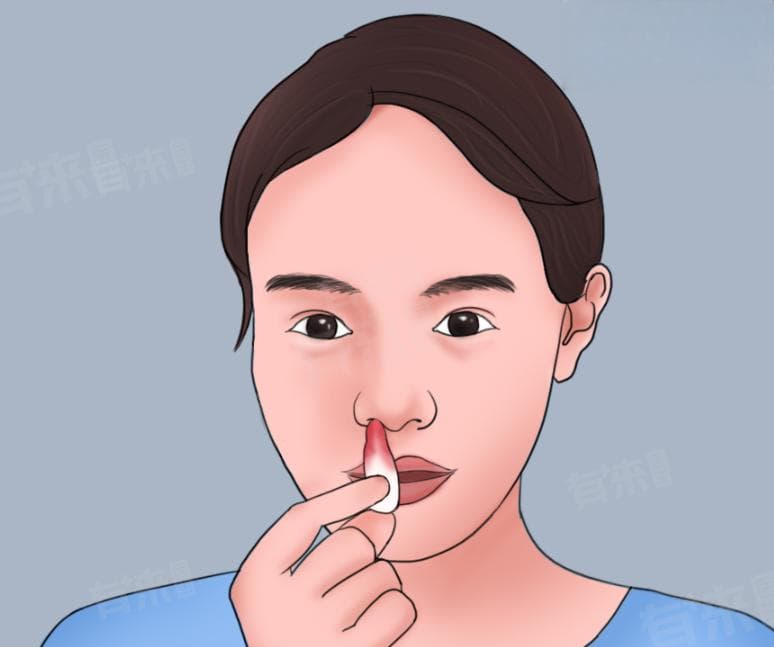 孕期流鼻血怎么回事