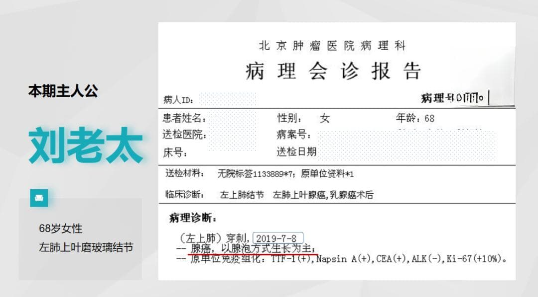 权威解读：肺结节的生长速度与风险评估