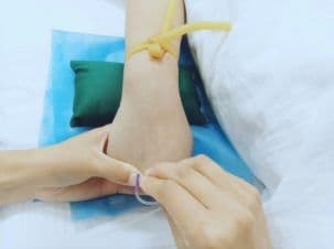 静脉输液后穿刺部位淤青怎么办？这份专业指南请收好