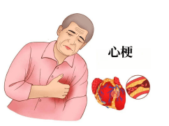 突发心肌梗死怎么急救这些护理知识帮到你